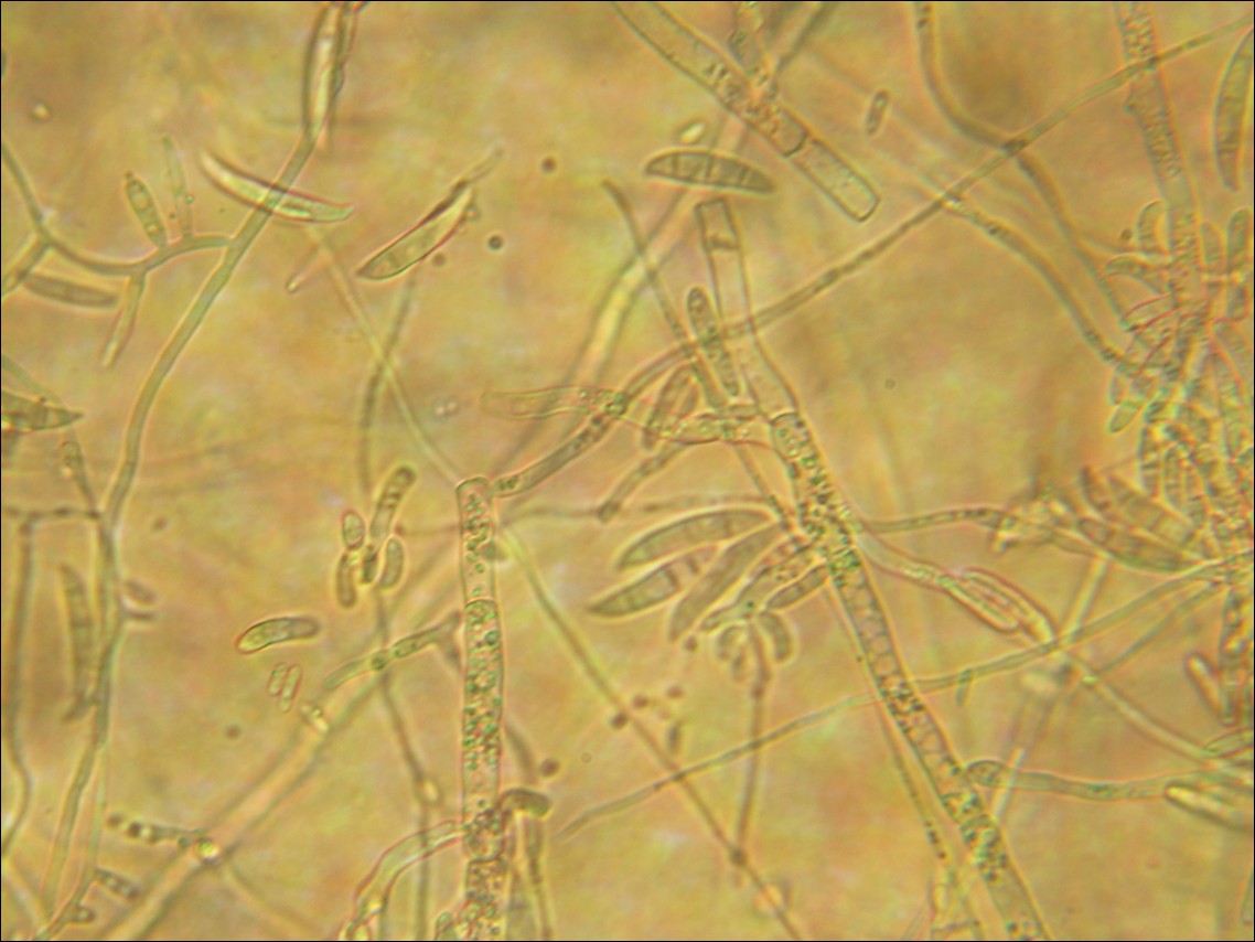 Light microscopy: Fusarium conidiophores bearing sickle-shaped macroconidia at 160x magnification
